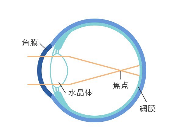 近視とは