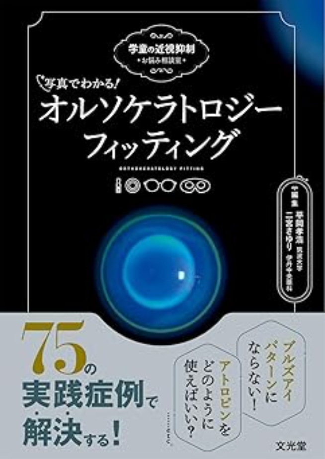 学童の近視進行抑制治療